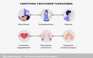 Алгоритм действий при синусовой тахикардии у ребенка