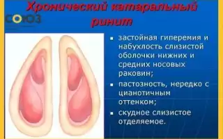 Какие опасности таит в себе субатрофический ринит