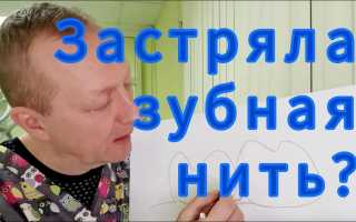 Что делать, если застряла зубная нить между зубов