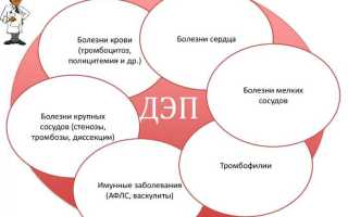 Болезнь мелких сосудов головного мозга