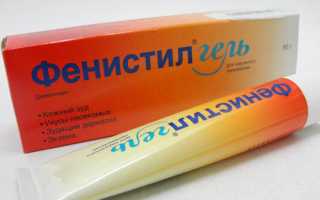 Какую мазь от крапивницы выбрать: плюсы и минусы