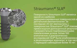 Импланты Straumann: обзор бренда