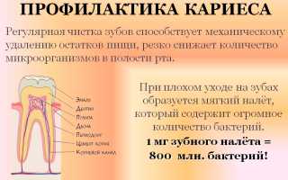 Средний кариес: симптомы, диагностика и лечение