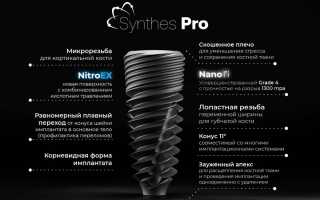 Зубные импланты Synthes Pro и NCTi