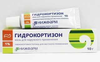 Эффективные мази от себорейного дерматита