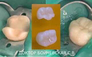 Что делать если выпала пломба?