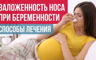 Чем опасен ринит беременных