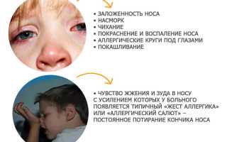 Когда нужна помощь при сезонном рините