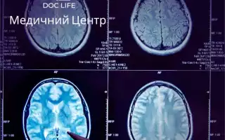 Микроангиопатия