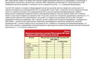Особенности брадикардии у детей различных возрастов