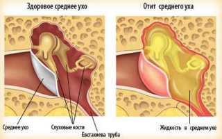 Почему ухо чешется внутри и мокнет