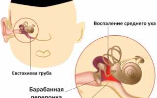 Опасен ли прокол барабанной перепонки при отите