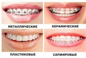 Фото: Виды конструкций